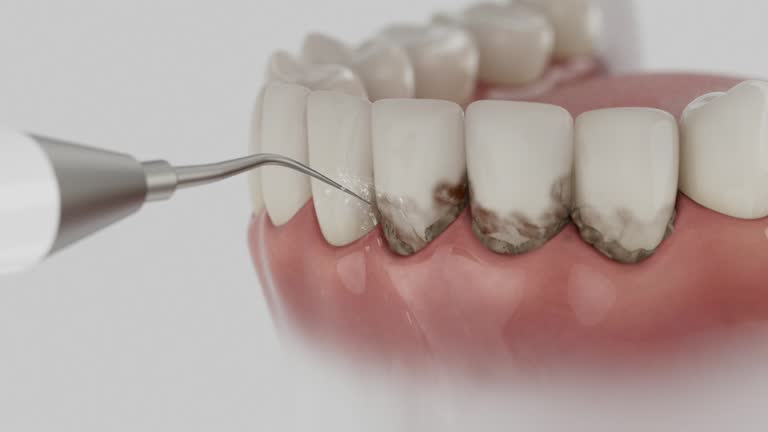 Trusted Tooth Extraction service in Barron, WI - Dentist Open Now